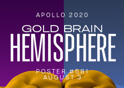 Gold Brain Hemisphere Poster #581